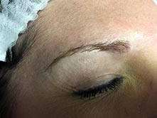 Micrbladed eyebrow procedure before