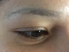 microblading eyebrow procedure