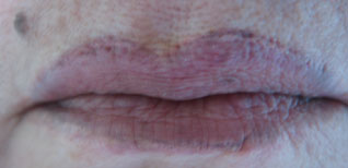 Edda Garcia Permanent Makeup Lip Liner Procedure