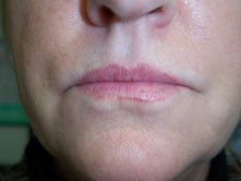 Edda Garcia Permanent Makeup Lip Liner Procedure